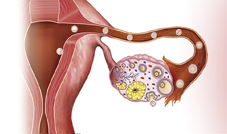 Anovulación crónica y amenorrea: cómo se aborda en Naprotecnología -  Fertilitas